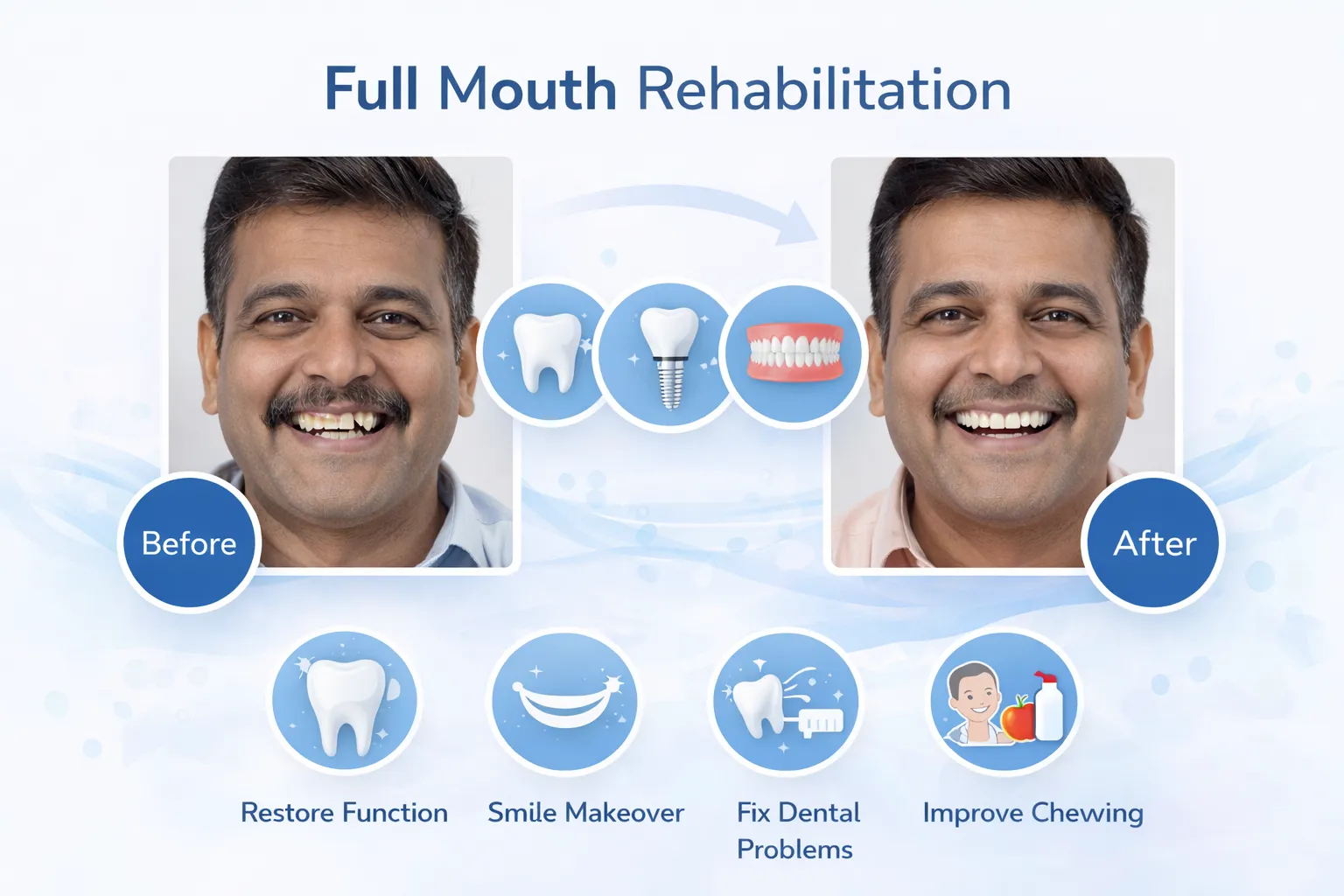 Full Mouth Rehabilitation​